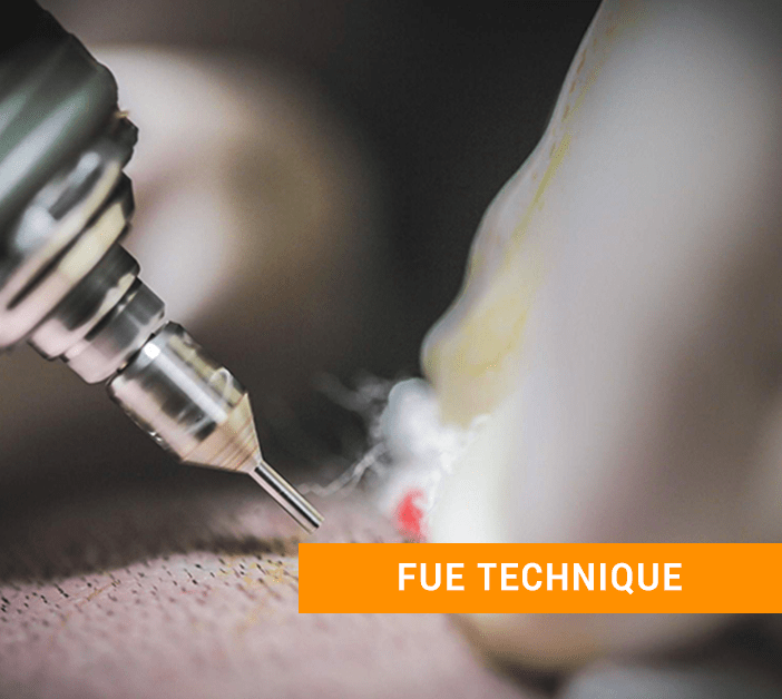 FUE follicular unit extraction