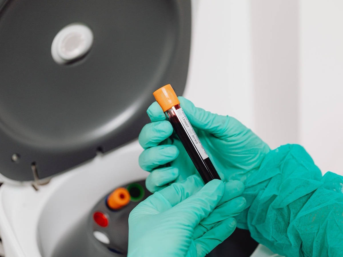 A gloved hand holding a sample tube at an open centrifuge