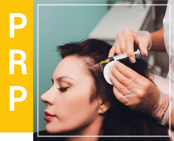 PRP hair treatment