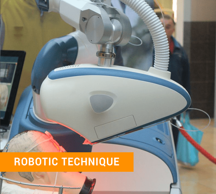 Robotic hair transplant system
